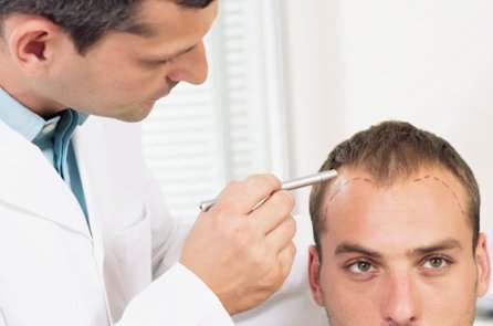 Hair Loss Causes