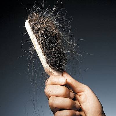 Hair Loss Causes