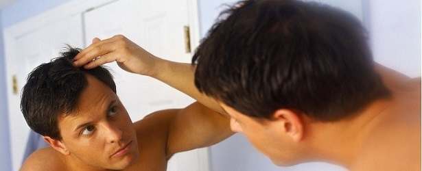 Herbal Treatments to Prevent Baldness